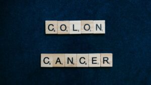 New Rules To Help Stop Cancer Of The Colon 300x169, Health Channel