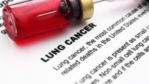 Lung Cancer Thumbnail 300x169, Health Channel