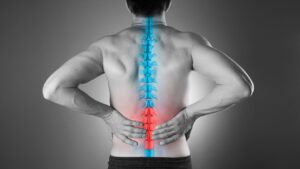 Treating Sciatica: A Very Common Back Pain Condition